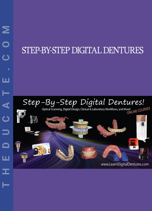 Step-by-Step Digital Dentures