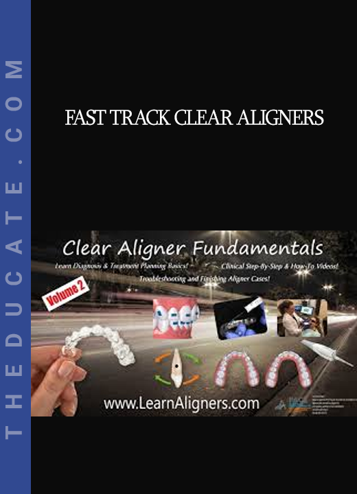 Fast Track Clear Aligners